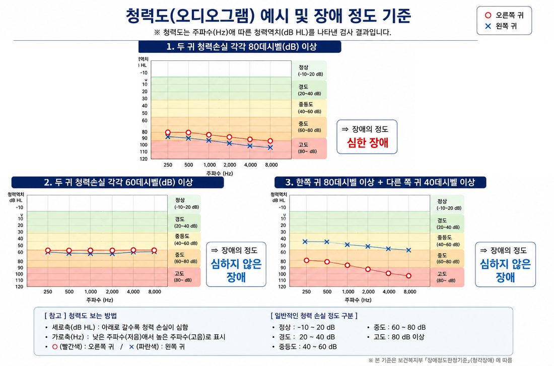 청력도(오디오그램) 예시로 보는 청각장애 정도 판정기준